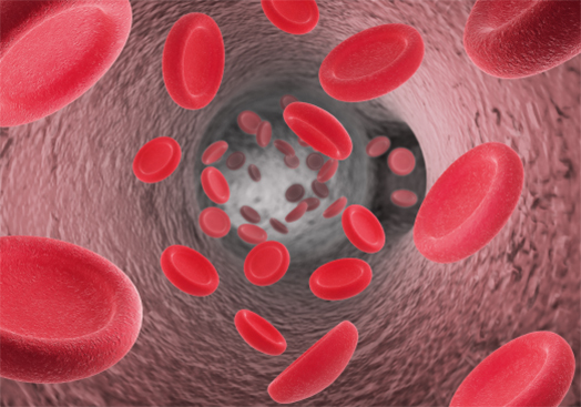 Hyperlipidemia